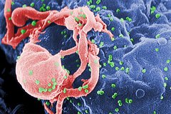 Объяснен механизм контроля вируса без лекарств у некоторых зараженных ВИЧ